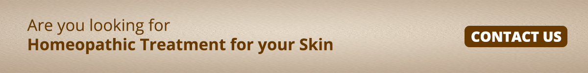 Homoeopathic Treatment for Skin Homoeopathic Treatment for Skin