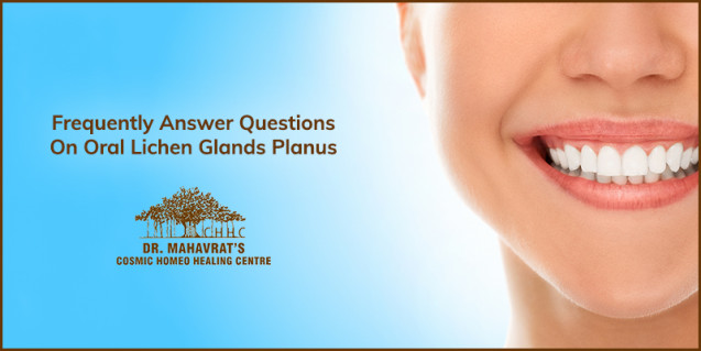 FAQ On Oral Lichen Glands Planus