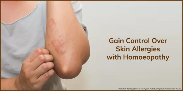 Gain Control Over Skin Allergies with Homoeopathy