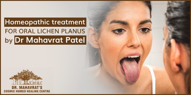Homeopathic treatment for Oral Lichen Planus by Dr. Mahavrat Patel