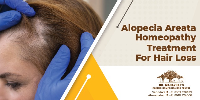 Alopecia Areata Homeopathy Treatment For Hair Loss