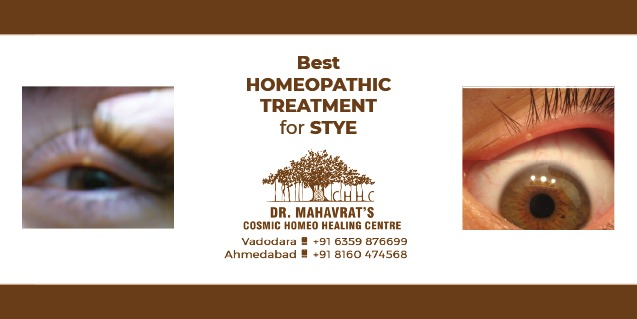 Best Homeopathic Treatment Of Stye