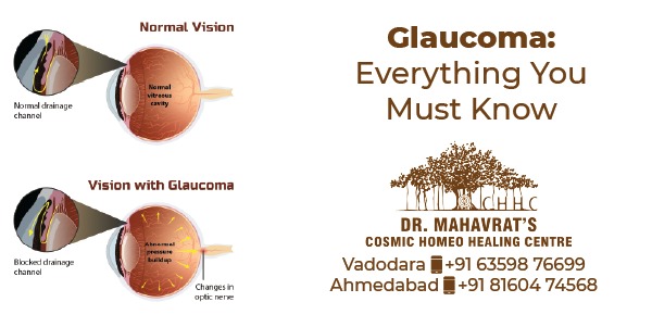Glaucoma Everything You Must Know