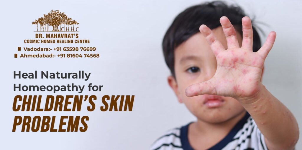 Talking Problem Homepathy Homeopathy for Skin Problems in Children: Natural Relief