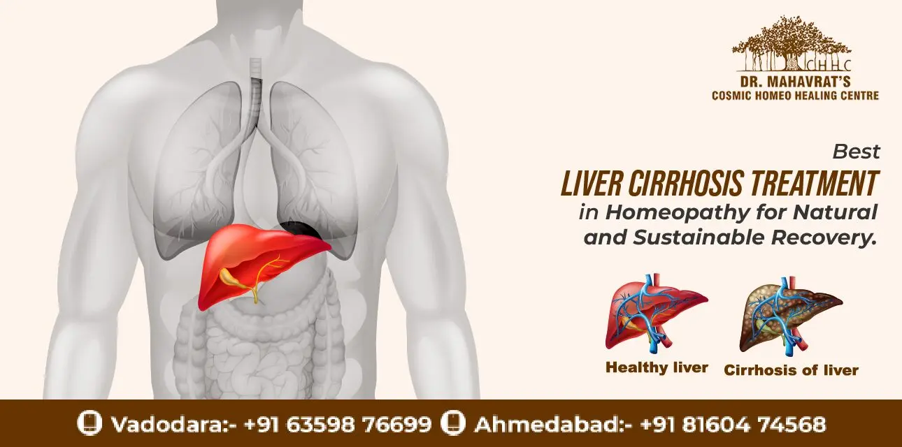 Liver Cirrhosis Treatment-CHHC