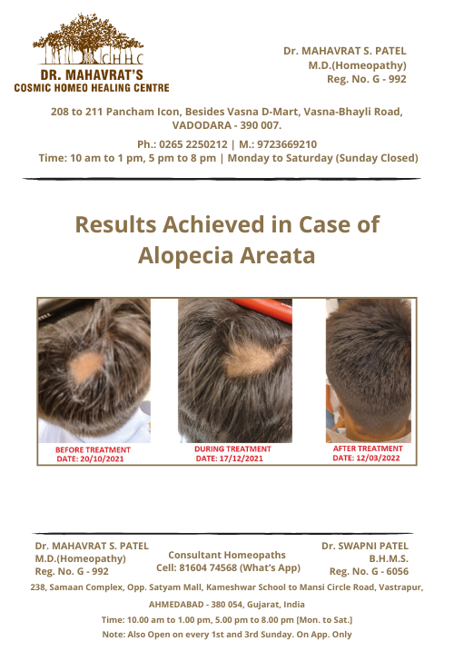 Alopecia-Areata