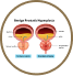 Benign Prostatic Hyperplasia icon
