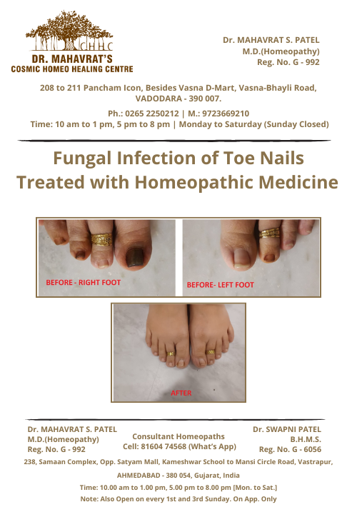 Fungal-infection