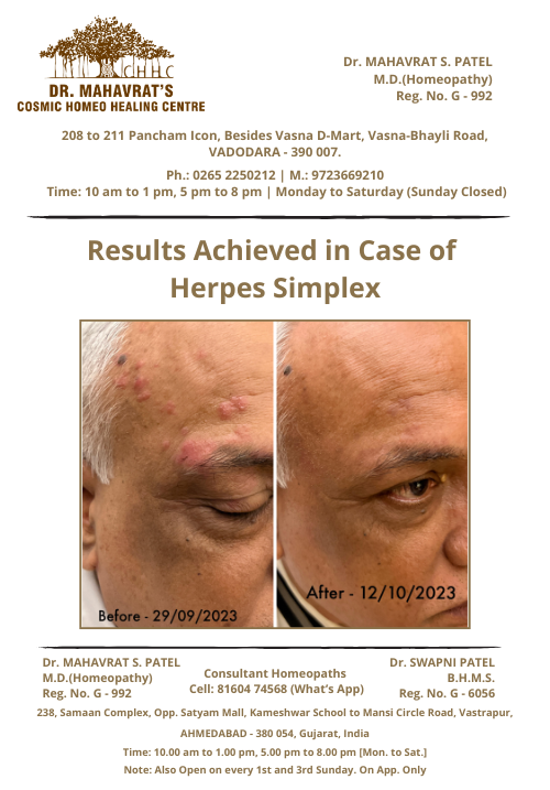 Herpes-Simplex