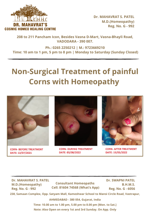 Painful-corn