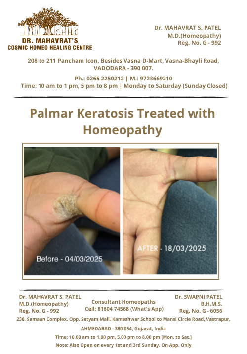 Palmar-Keratosis
