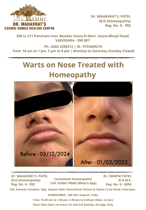 Warts-on-nose