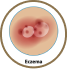 eczema icon