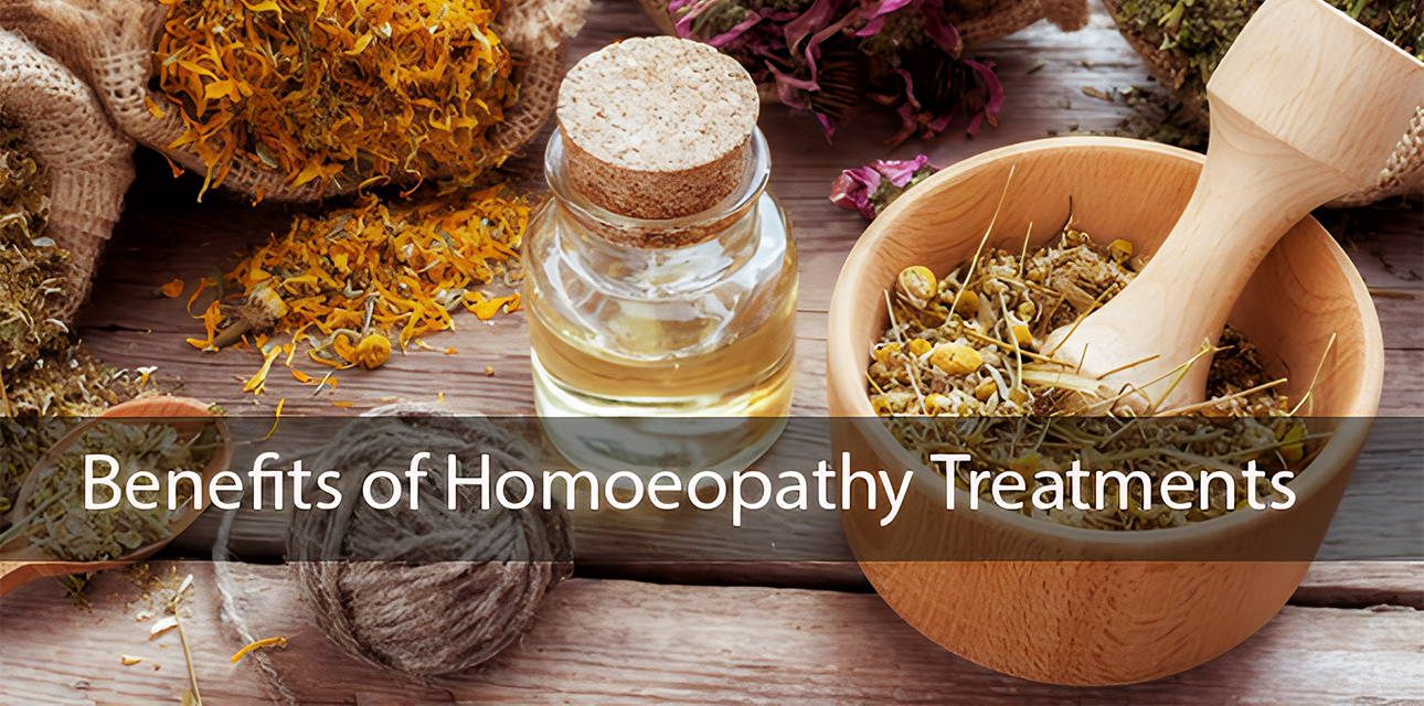 3 Benefits of Homeopathy Treatments