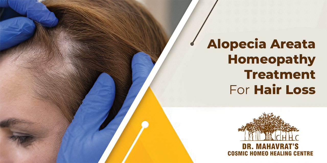 Alopecia Areata Homeopathy Treatment For Hair Loss