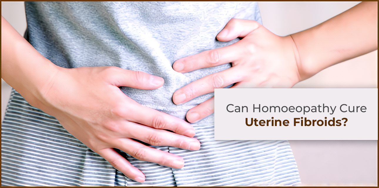 Can Homoeopathy Cure Uterine Fibroids?
