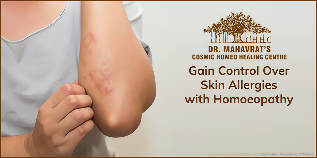 Gain Control Over Skin Allergies with Homoeopathy