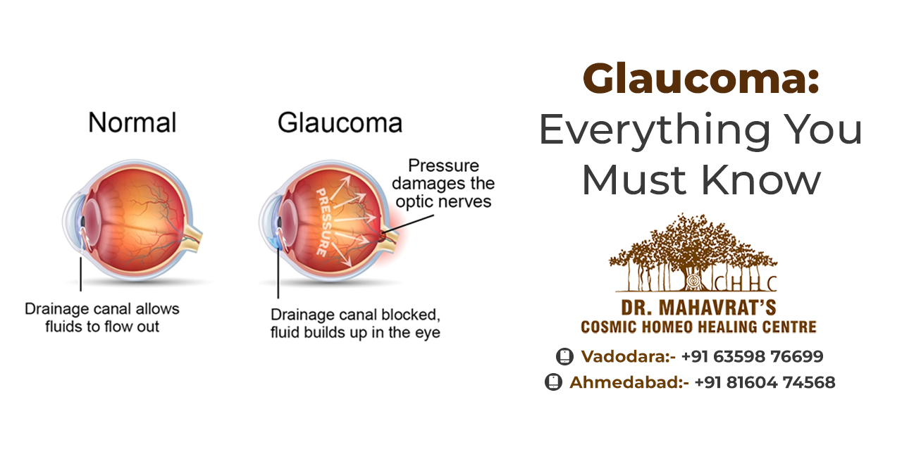 Glaucoma: Everything You Must Know