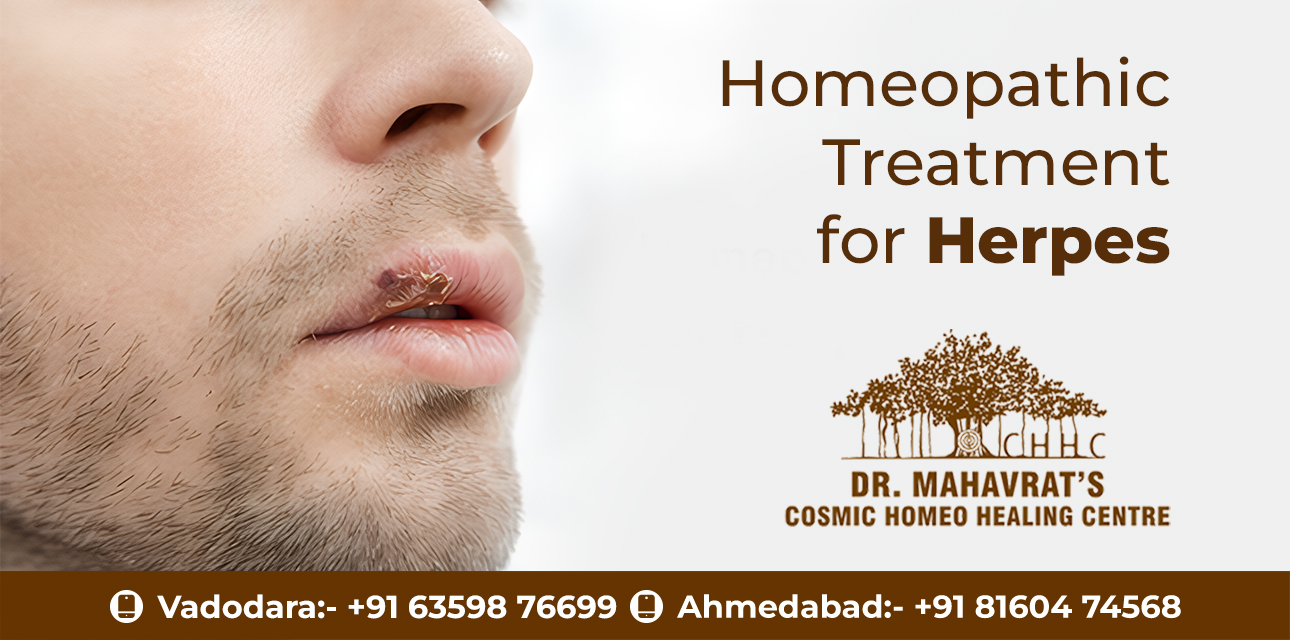Homeopathic Treatment For Herpes