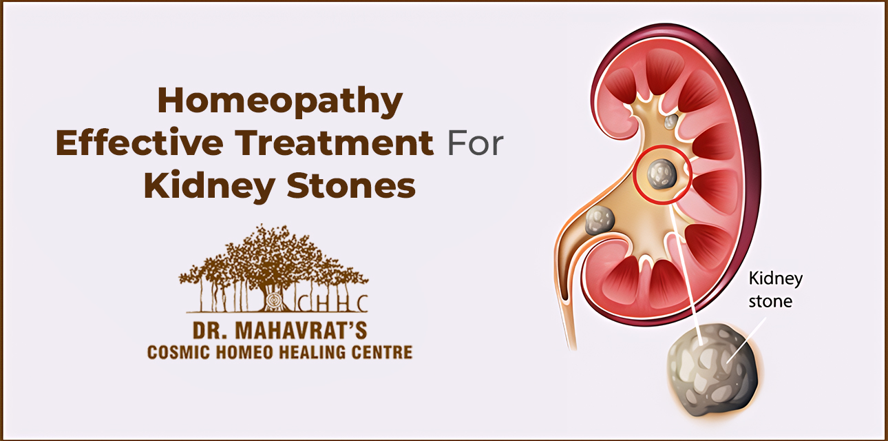 Homeopathy Effective Treatment For Kidney Stones