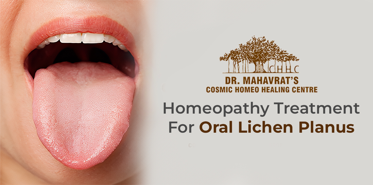 Homeopathy Treatment for Oral Lichen Planus