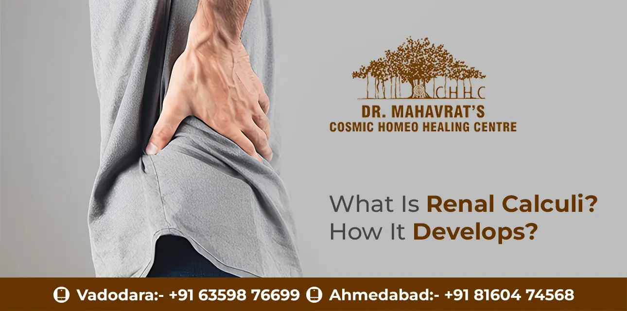 What Is Renal Calculi? How It Develops?