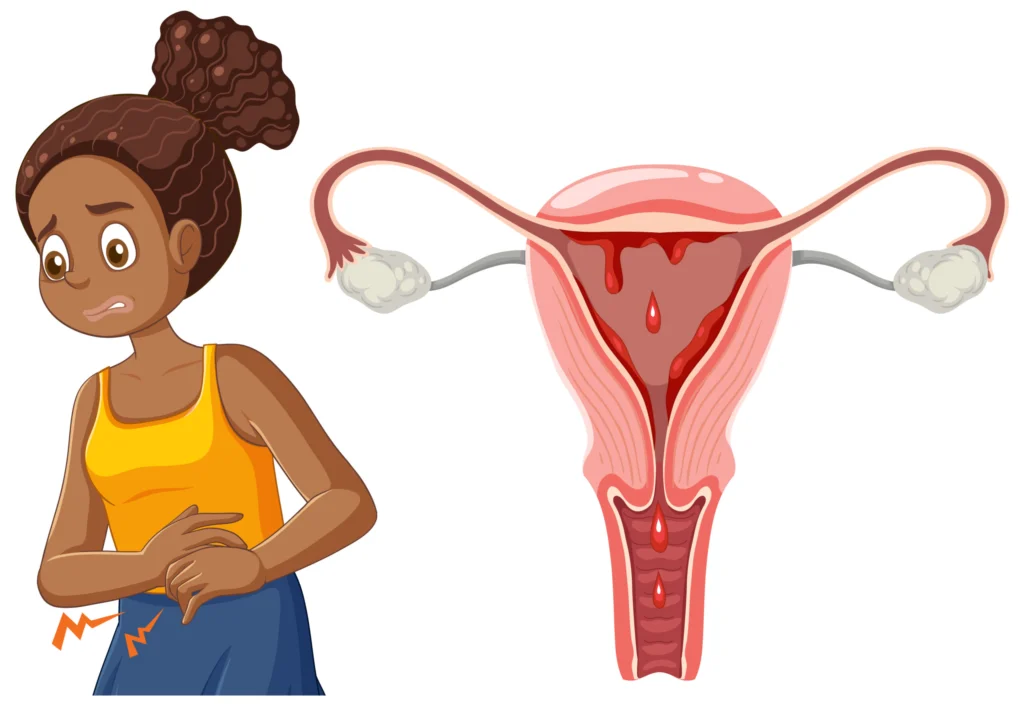 African American Girl Experiencing Menstrual Cramps During Puber