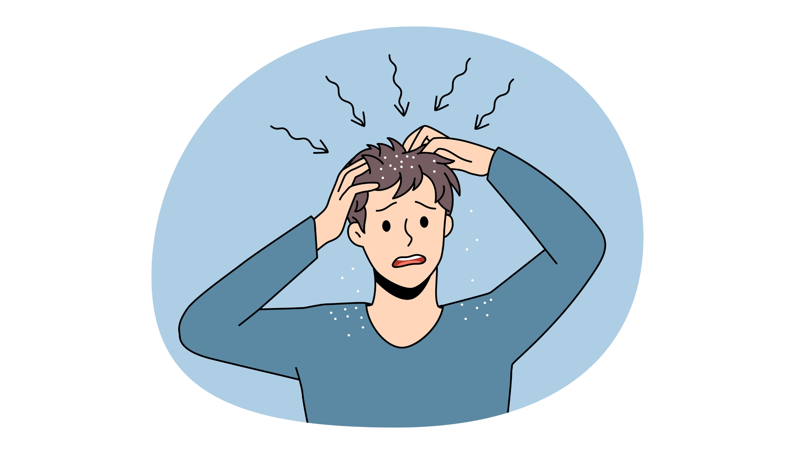 Seborrheic Dermatitis - CHHC