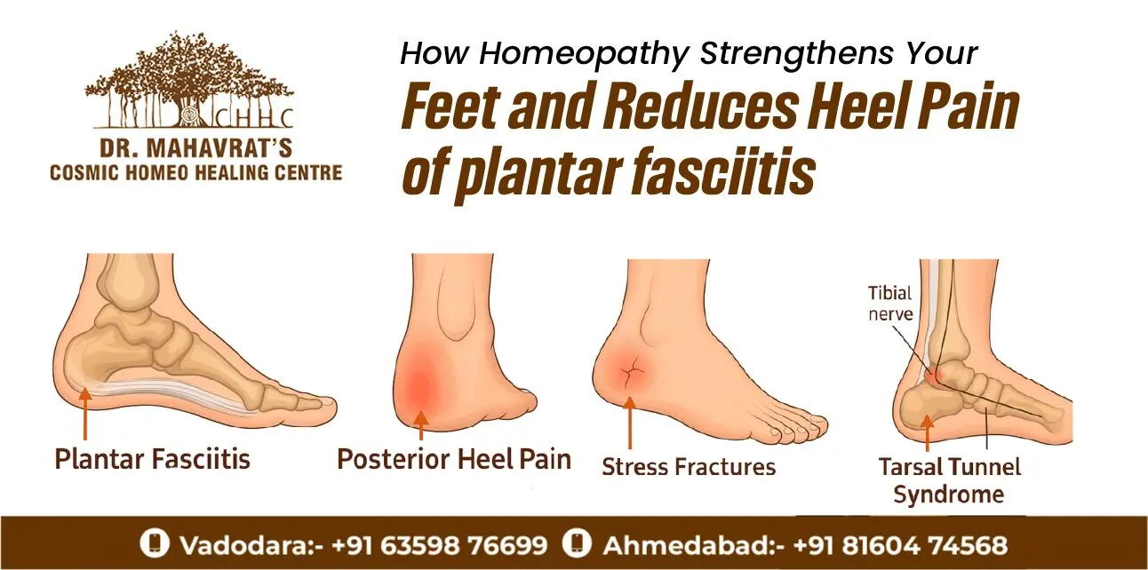 Heel Pain Homeopathic Treatment